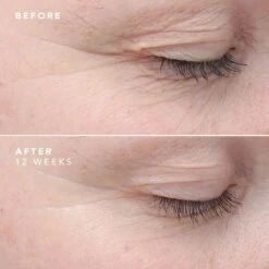 Bioeffect EGF Eye Serum -Lanvin Paradise 5694230071708 alt2